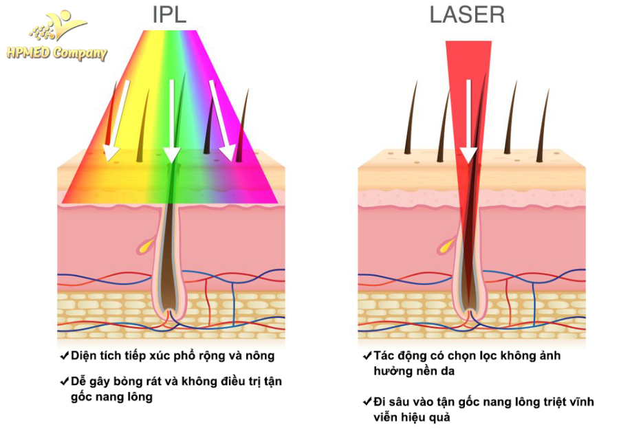 Máy Laser YAG Là Gì? Nguyên Lý Hoạt Động Của Công Nghệ Laser YAG 2025 3 Máy Laser YA