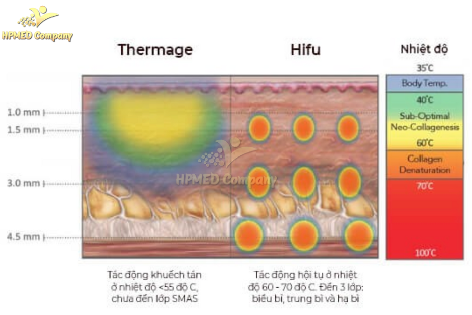 So sánh Công nghệ HIFU và Thermage