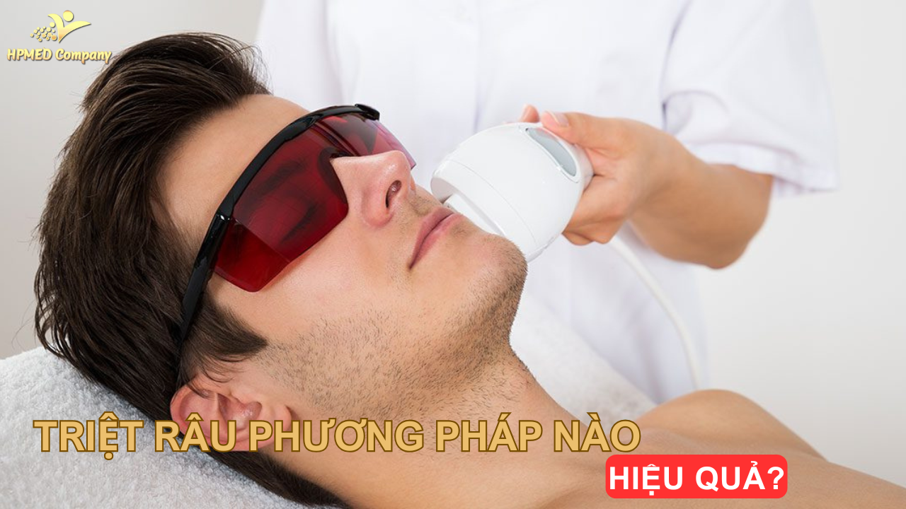 Triệt râu phương pháp nào tốt ? chi phí bao nhiêu ? 1 Giới thiệu về triệt râu