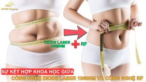 Sự kết hợp khoa học giữa công nghệ giảm béo Diode Laser 1060nm và Công nghệ giảm béo RF
