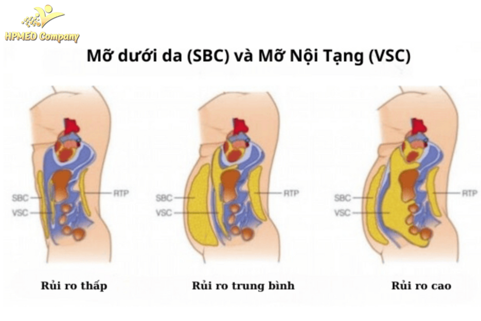Cách nhận biết lượng mỡ nội tạng trong cơ thể