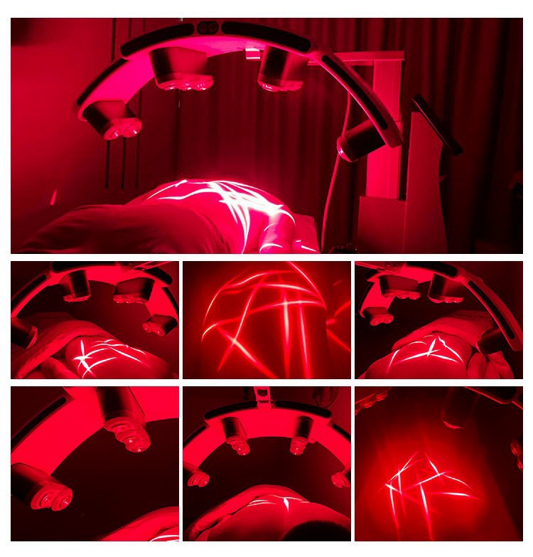 MAY GIAM BEO LUXMASTER SLIM LASER 532NM 14