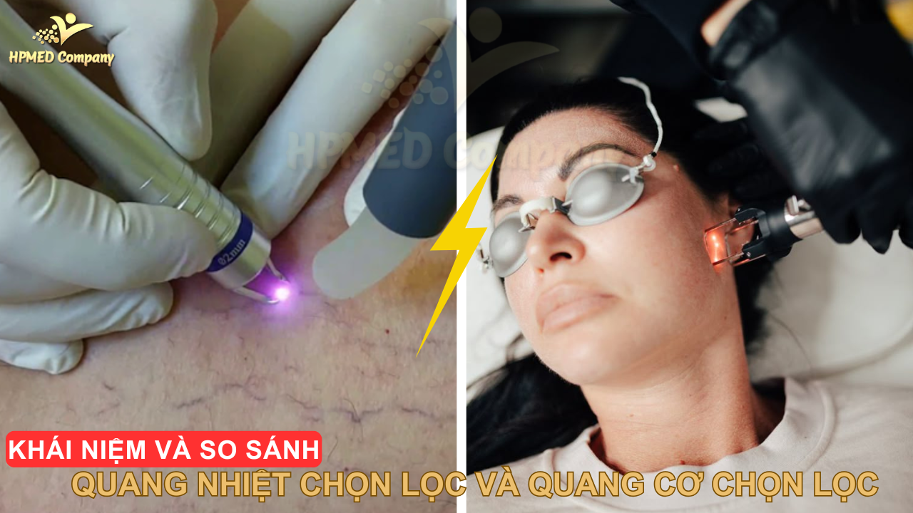 Khái niệm và So sánh quang nhiệt chọn lọc và quang cơ chọn lọc