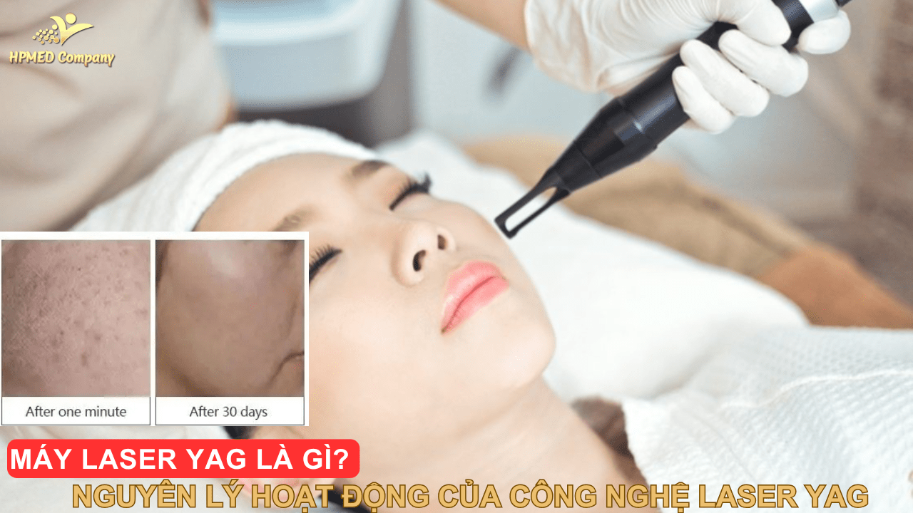 Máy Laser YAG Là Gì? Nguyên Lý Hoạt Động Của Công Nghệ Laser YAG 2025 1 Máy Laser YAG Là Gì? Nguyên Lý Hoạt Động Của Công Nghệ Laser YAG 2025