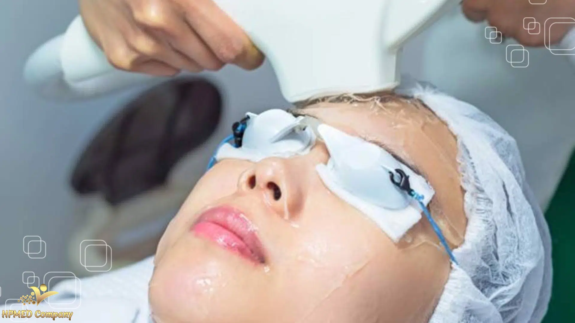 So sánh công nghệ triệt lông Diode Laser và DPL So sánh công nghệ triệt lông Diode Laser và DPL