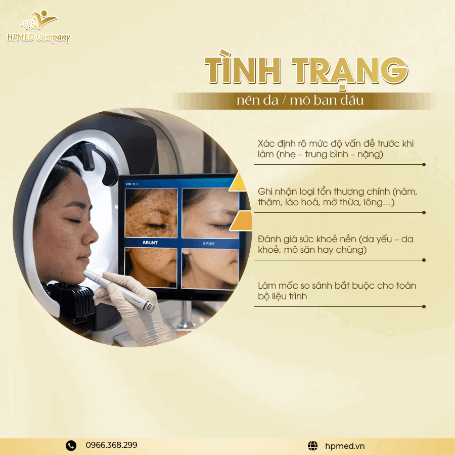 Khách hàng soi da bằng máy phân tích da chuyên dụng, màn hình hiển thị hình ảnh tổn thương và tình trạng da ban đầu
