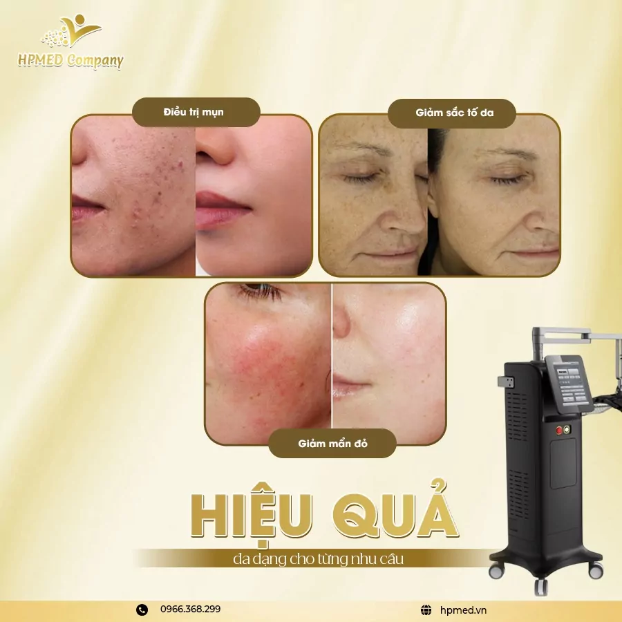 Đèn Ánh Sáng Sinh Học HPmed Chính Hãng Cao Cấp