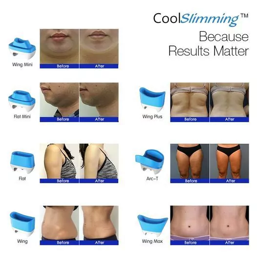 Máy Giảm Béo Quang Đông 360 Cryolipolysis 💎 Giải Pháp Làm Gọn Vóc Dáng An Toàn Cho Spa Hiện Đại