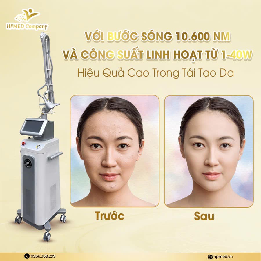 Sửa Chữa Máy Laser Co2 Fractional Tại Hà Nam Kinh Nghiệm và Lời Khuyên Của Chuyên Gia