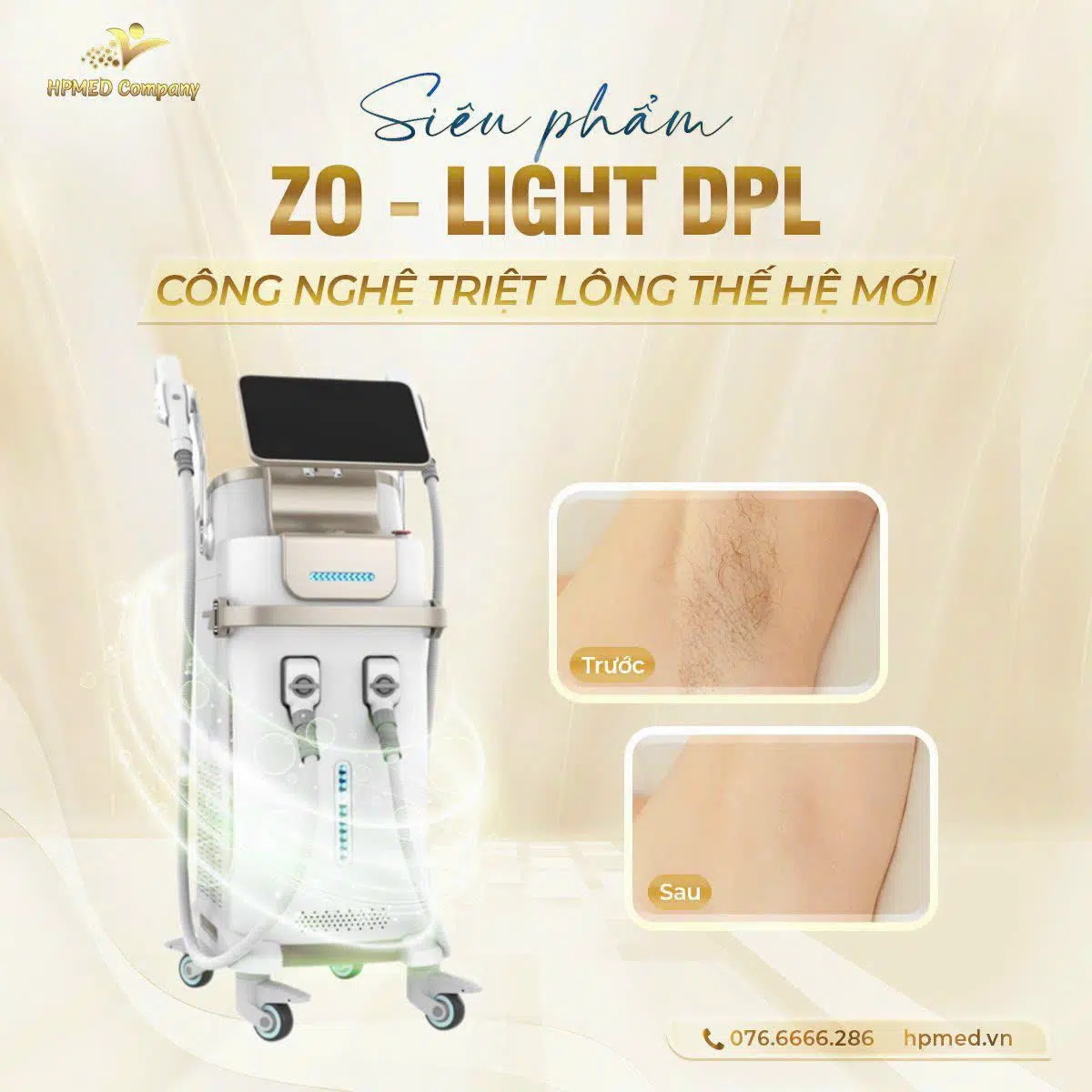 Máy Triệt Lông DPL Spectrum | Cao Cấp Bắc Kinh