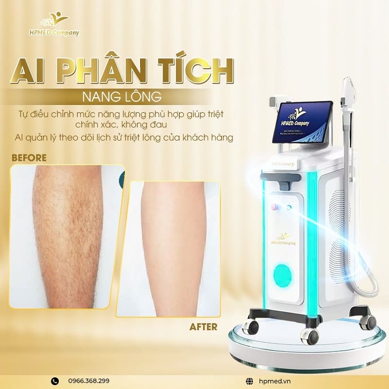 Máy Triệt Lông Diode Laser Cao Cấp